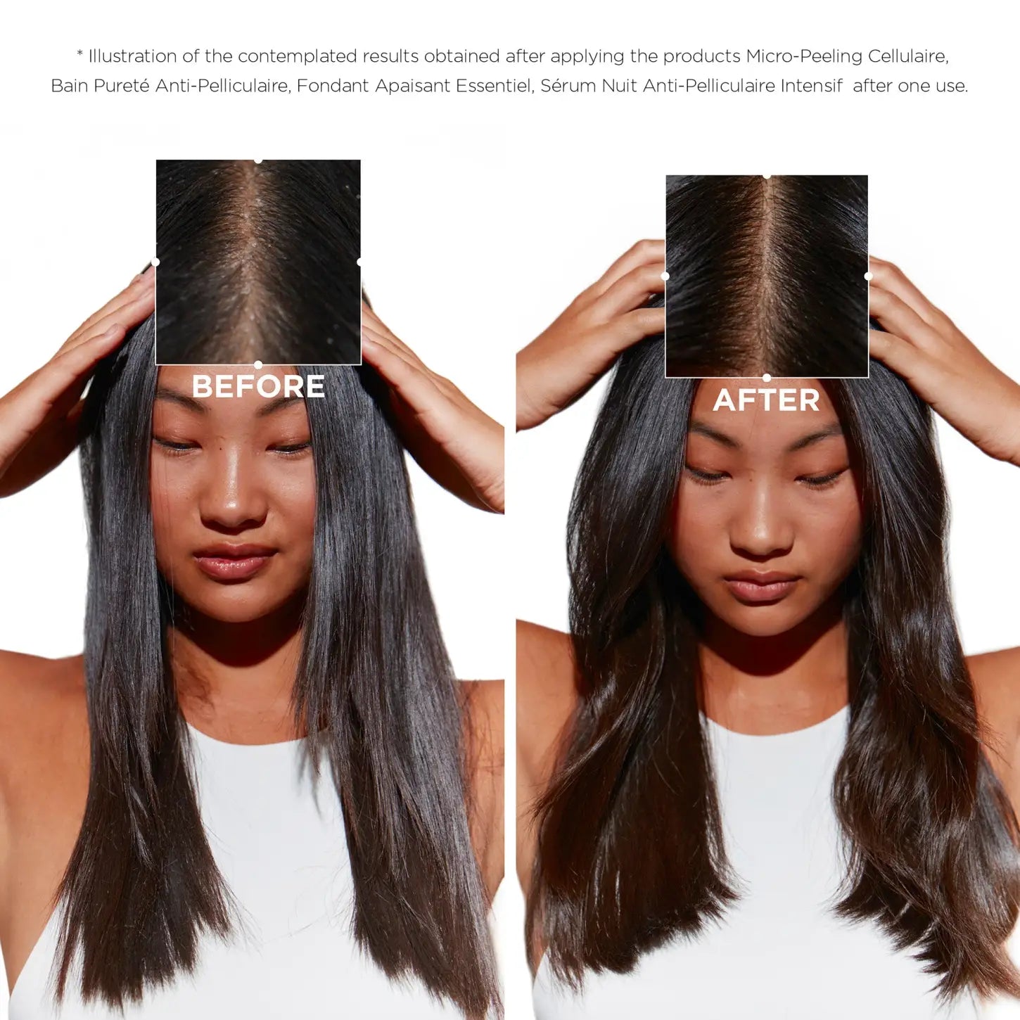 Kerastase Symbiose Dandruff Shampoo Before & After: Scalp Transformation