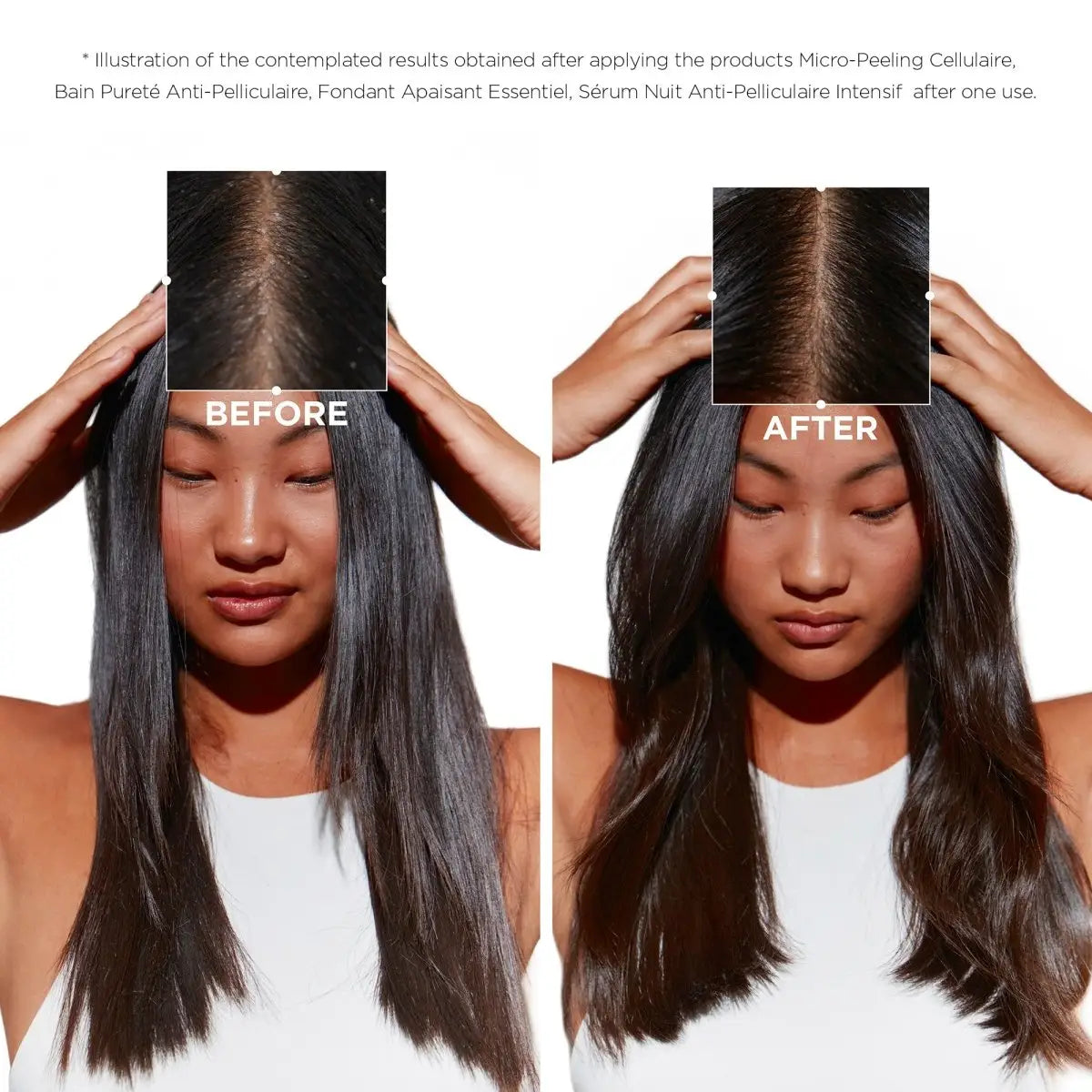 Kerastase Symbiose: Before & After Scalp Treatment. Anti-dandruff results with Fondant Apaisant Essentiel.