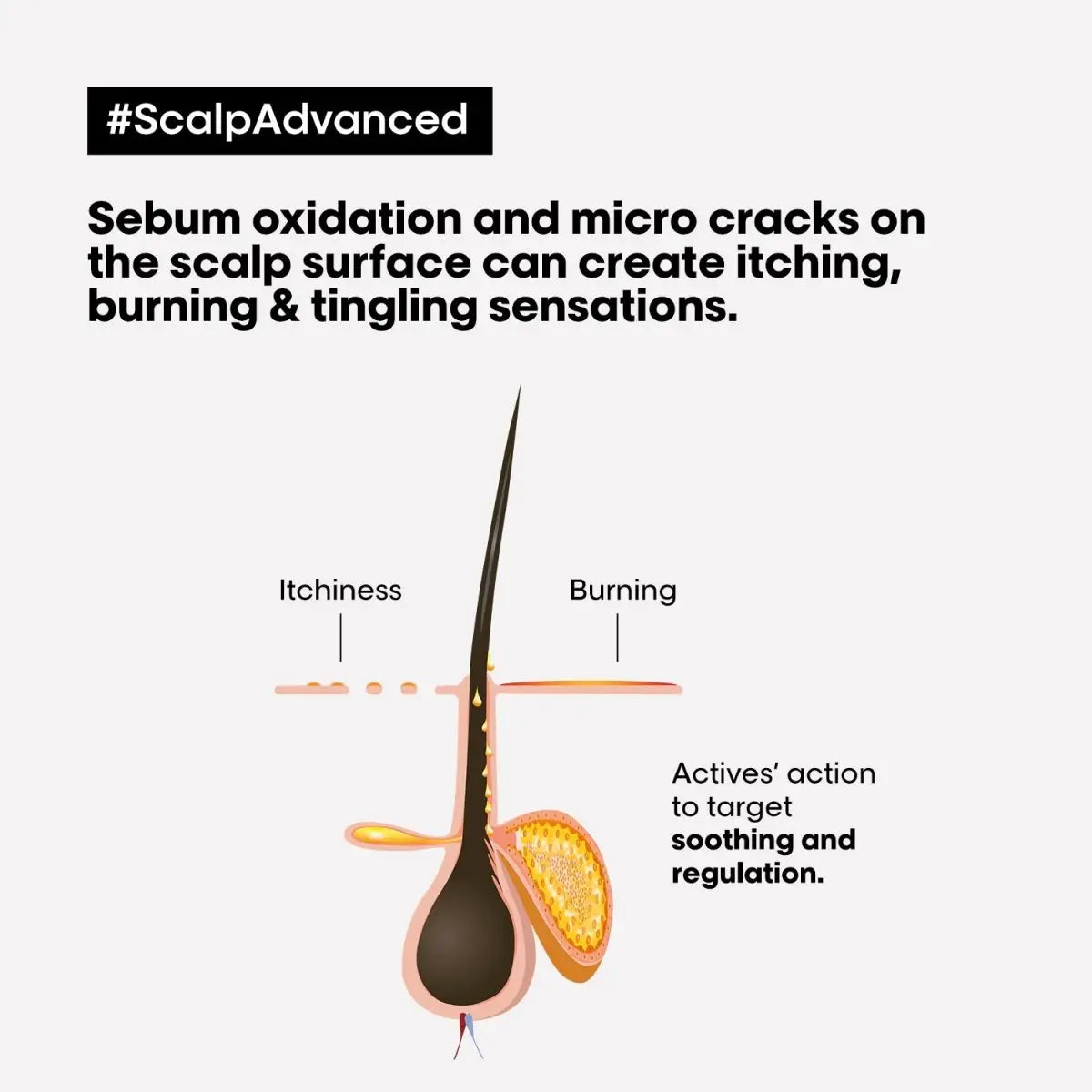 Itchy Scalp & Sebum: L'Oréal Professionnel Anti-Discomfort Shampoo targets scalp issues at the hair follicle.