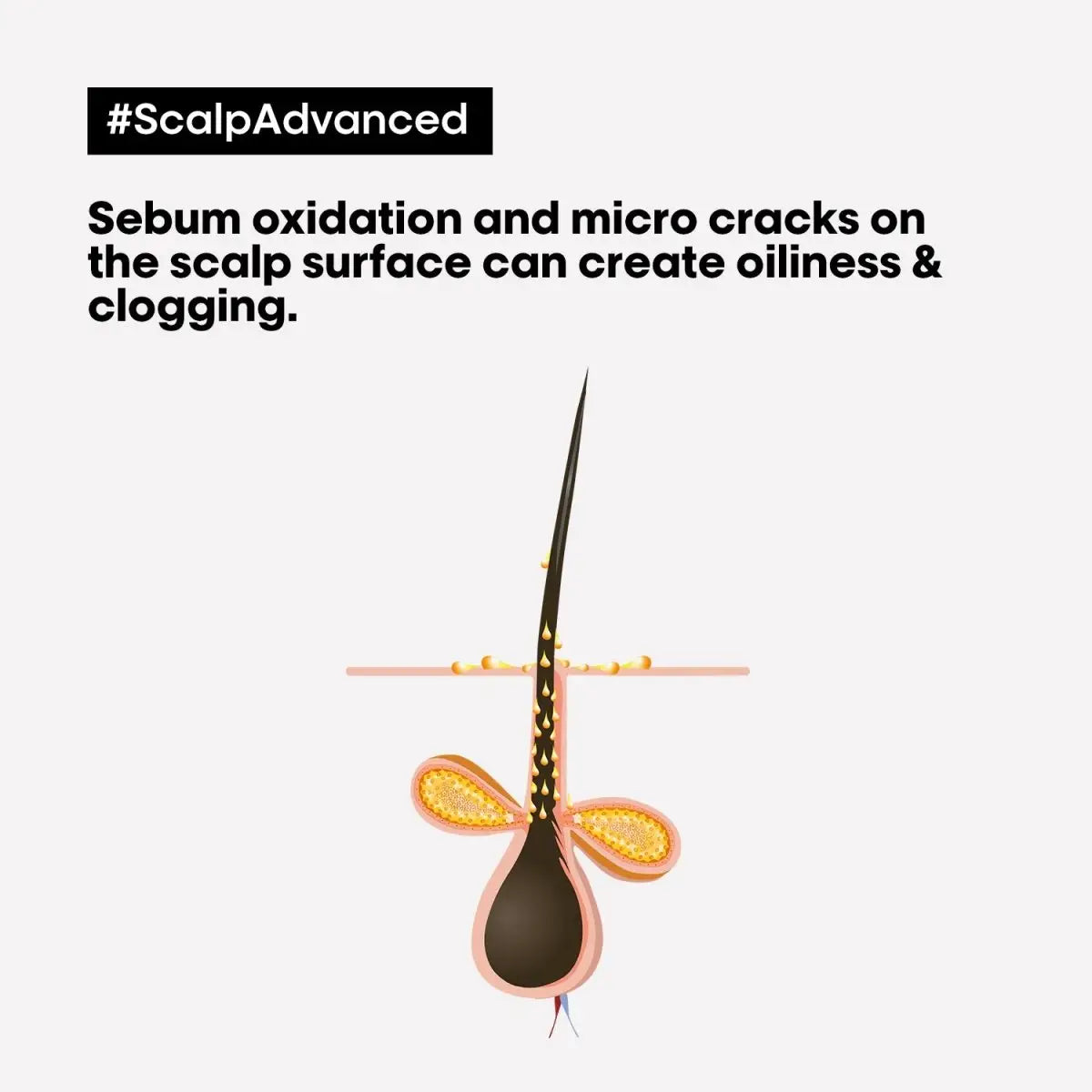 Scalp Advanced: Sebum Oxidation & Oily Scalp Illustration | L'Oreal Solution for Oily Hair & Clogged Pores