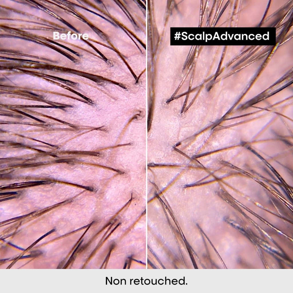 Close-up of scalp and hair follicles before and after using L’Oreal Anti-Discomfort Intense Soother