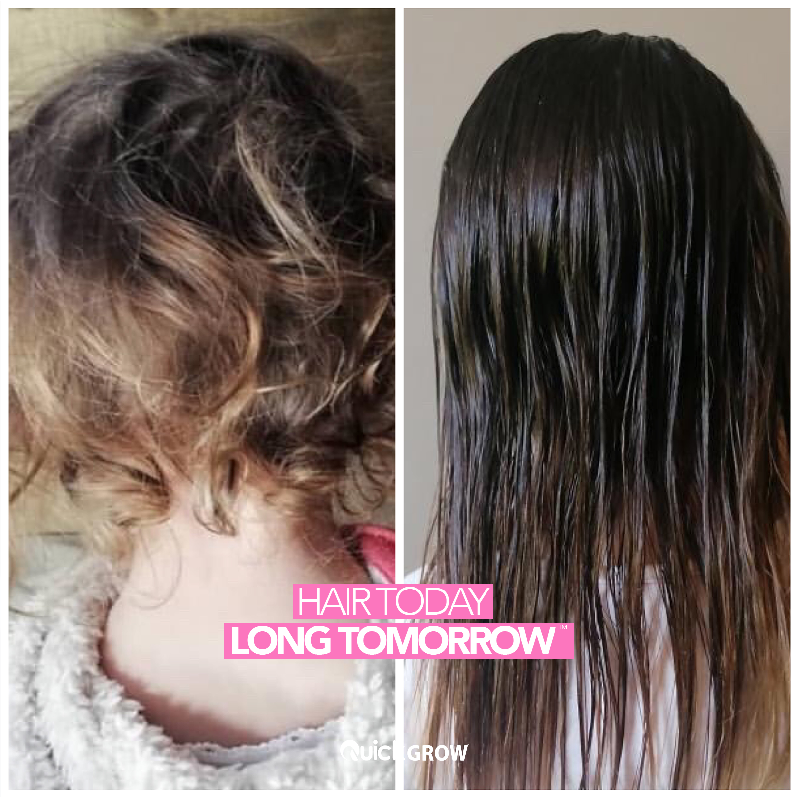 Before-and-after customer hair results for Quick Grow Sulphate-Free Biotin Shampoo 500ml
