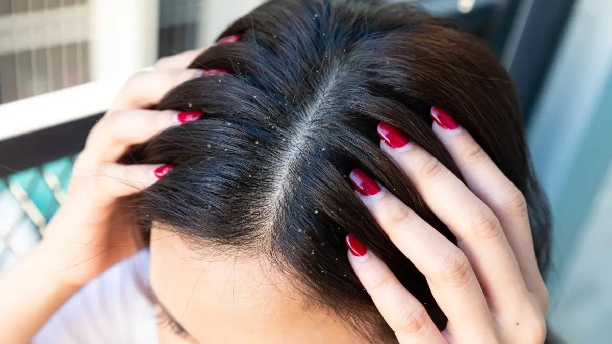 Close-up of hands with red nails in dark hair, highlighting scalp conditions to promote hair growth.