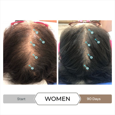 DS Laboratories Spectral DNC-N 3 Month Supply — Nanoxidil 5% Hair Density Serum