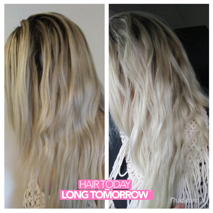 Before-and-after hair results for Quick Grow Blonde Icon Shampoo and Conditioner Box Set 500ml