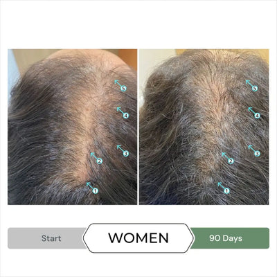 CBD Shampoo for Hair Growth: Women's 90-Day Before & After. See the difference!