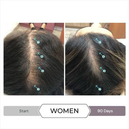 Before and after results showcasing the effectiveness of DS Laboratories Spectral Csf 60ml - Hair Loss Solution for women.