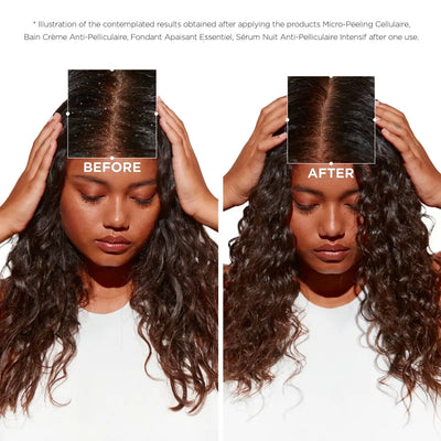 Kerastase Symbiose Anti-Dandruff Shampoo: Before & After Scalp Treatment Results. Dandruff-Free Hair Transformation