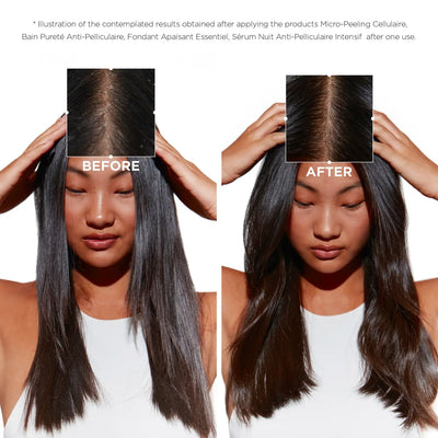 Kerastase Symbiose Dandruff Shampoo Before & After: Scalp Transformation