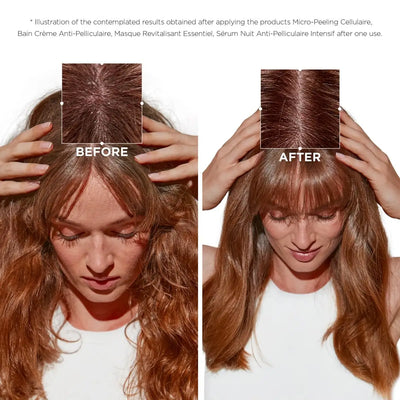 Before & After: Kerastase Symbiose Micro-Peeling Cellulaire for Dandruff. See the Results!