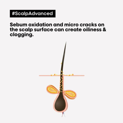 Scalp Advanced: Sebum Oxidation & Oily Scalp Illustration | L'Oreal Solution for Oily Hair & Clogged Pores