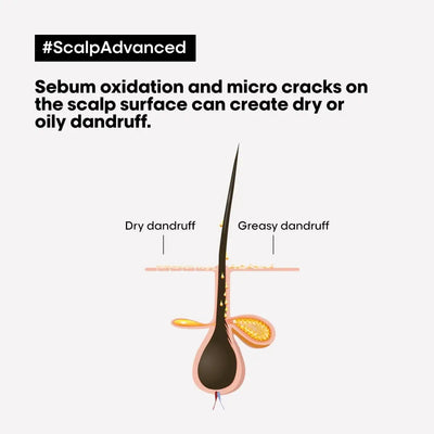 Sebum, Micro-cracks & Dandruff: Scalp Advanced Explained. Understand dry and oily dandruff causes.