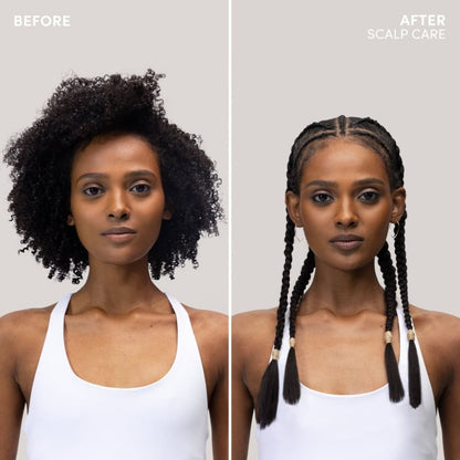 Before and after of natural curls to braids using Mizani Scalp Care Calming Lotion 118ml