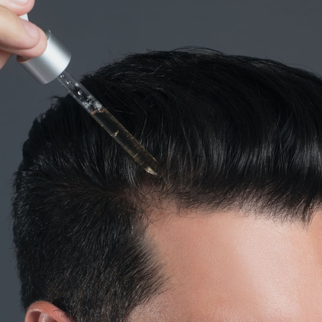 Applying Newtrino 100ml Scalp Serum to enhance hair density on a person’s dark scalp