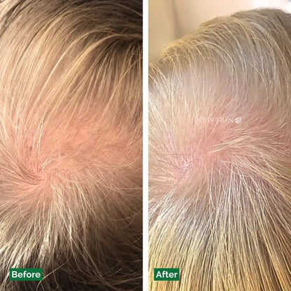 Close-up comparison of blonde hair before and after using Newtrino 100ml Scalp Serum treatment